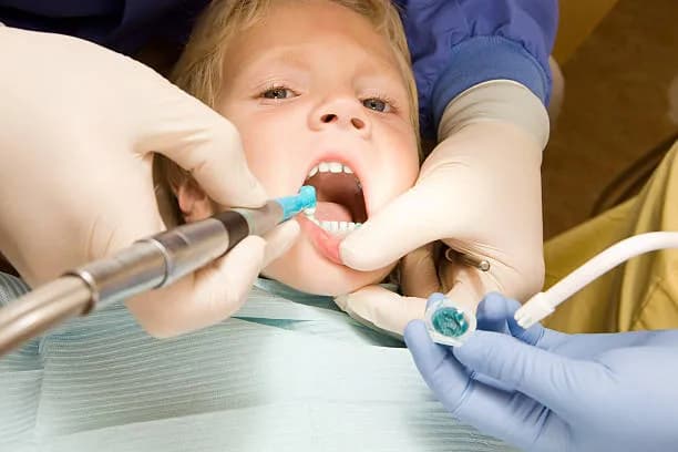 Fluoride treatments for children in Hamilton NJ